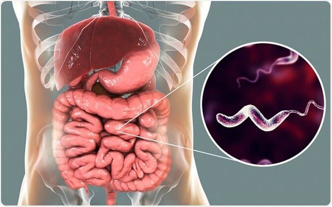 I parassiti rilasciano tossine nel corpo e il farmaco Vermixin ti aiuterà a sbarazzartene! 